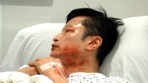 Chinese Officials: Deadly Virus Sweeping China Is Just Olympic F