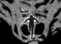 The Demon in the Snow picture