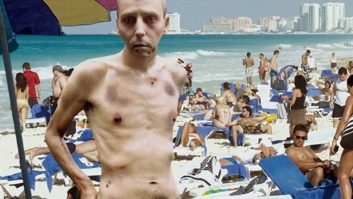Courageous Man Refuses To Believe He Has Cancer