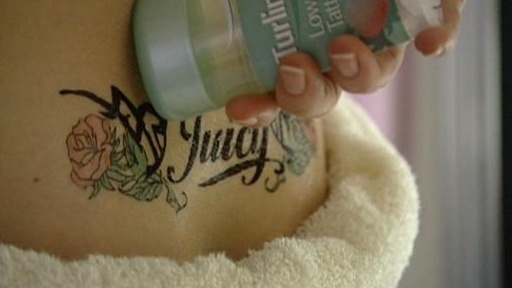 Turlington's Lower Back Tattoo Remover
