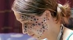 NBC TODAY Show: Teen Sues for Tattoo Gone Wrong