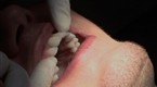 Tips and Tricks for Dental Care