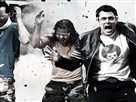 Jackass 3D: The Injuries