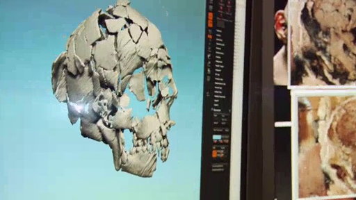 An Ancient Human Skull Video