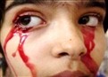 A Baffling Blood Disease picture
