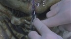 Independence Day: Alien Surgery