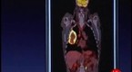 Medical imaging on Apple device