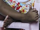 Tot Has 14 Toes, 12 Fingers