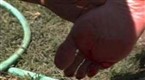 Flipping Out: Jenni's Bloody Foot